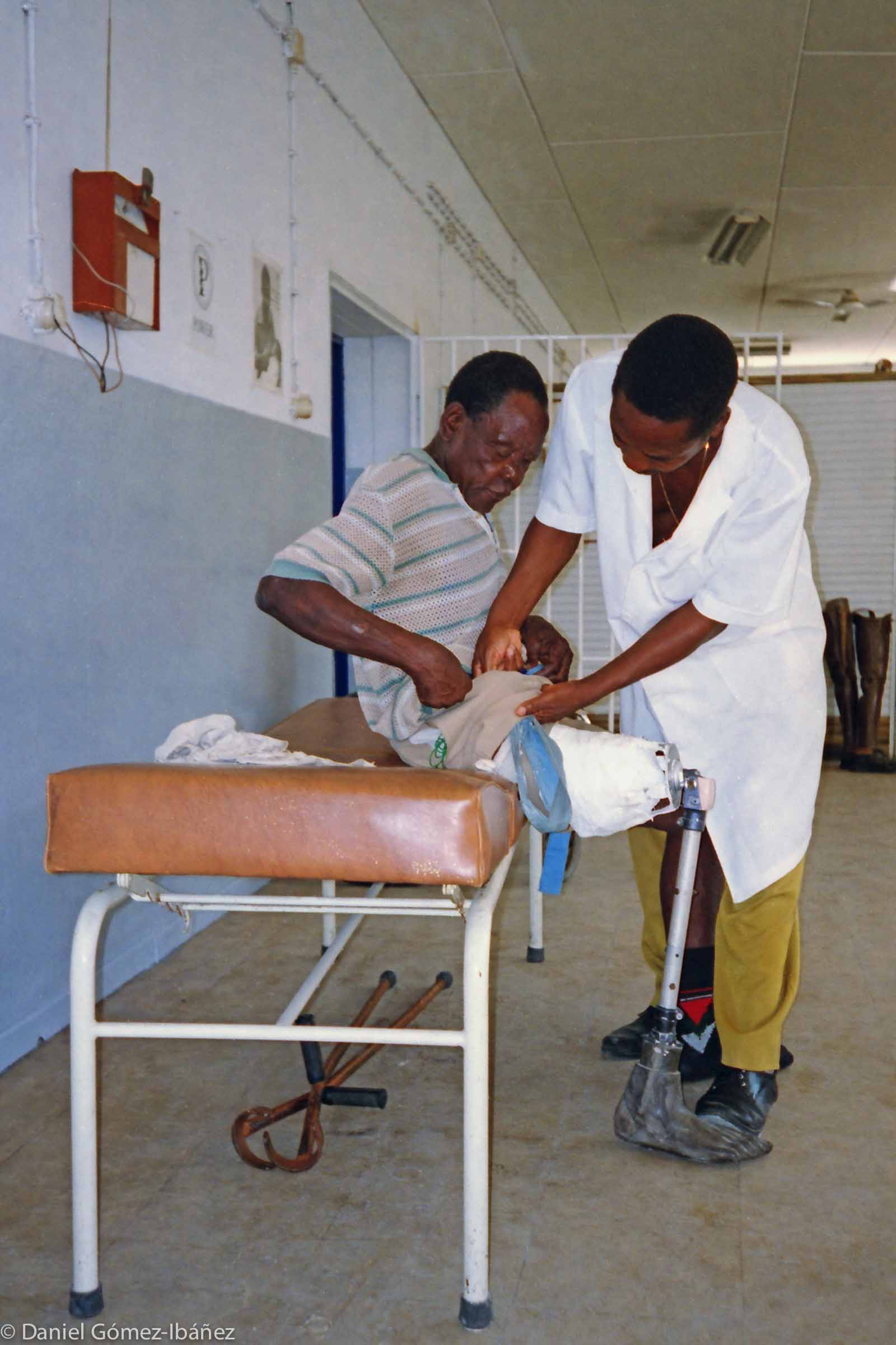 The prosthesis is attached to Chichava's stump.  © 1997