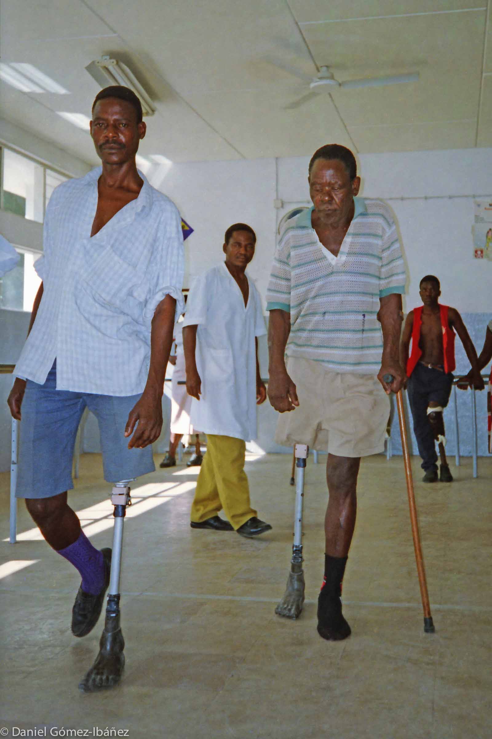 Progress! With just a single crutch Chichava tries walking on his new leg. Carlos Fabião Pelembe encourages him. © 1997